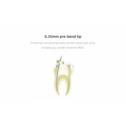 Woodpecker Trdls Obturator System Fi-G og Fi-P. Hurtig opvarmning af guttapercha.