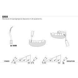 Woodpecker Scalerspids GK60 (5A) til Kavo Sonicflex 2008,