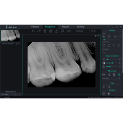Woodpecker i-Sensor. Digital Rntgensensor. Leveres i str. 1 og 2.