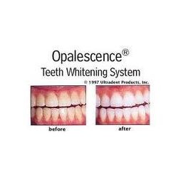 Opalescence PF. 4 x 1,2ml. Tandblegemiddel. 16% karbamidperoxid m/ kaliumnitrat, fluor og mintsmag